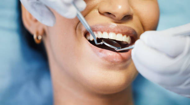 Best Emergency Root Canal Therapy in Sutton, NE